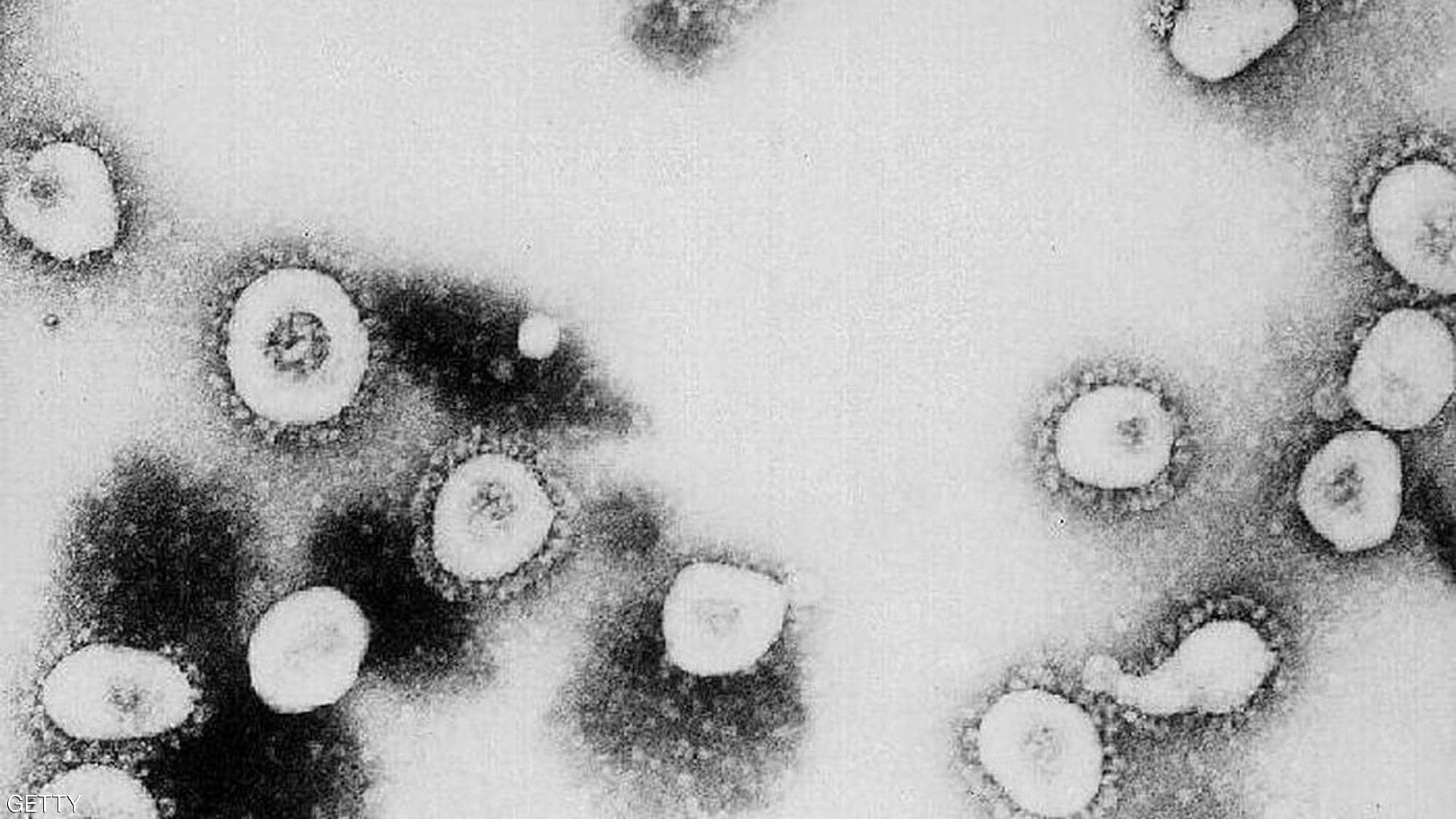 "كورونا جديد".. فيروس أسرع انتشاراً وأقل عدوانية