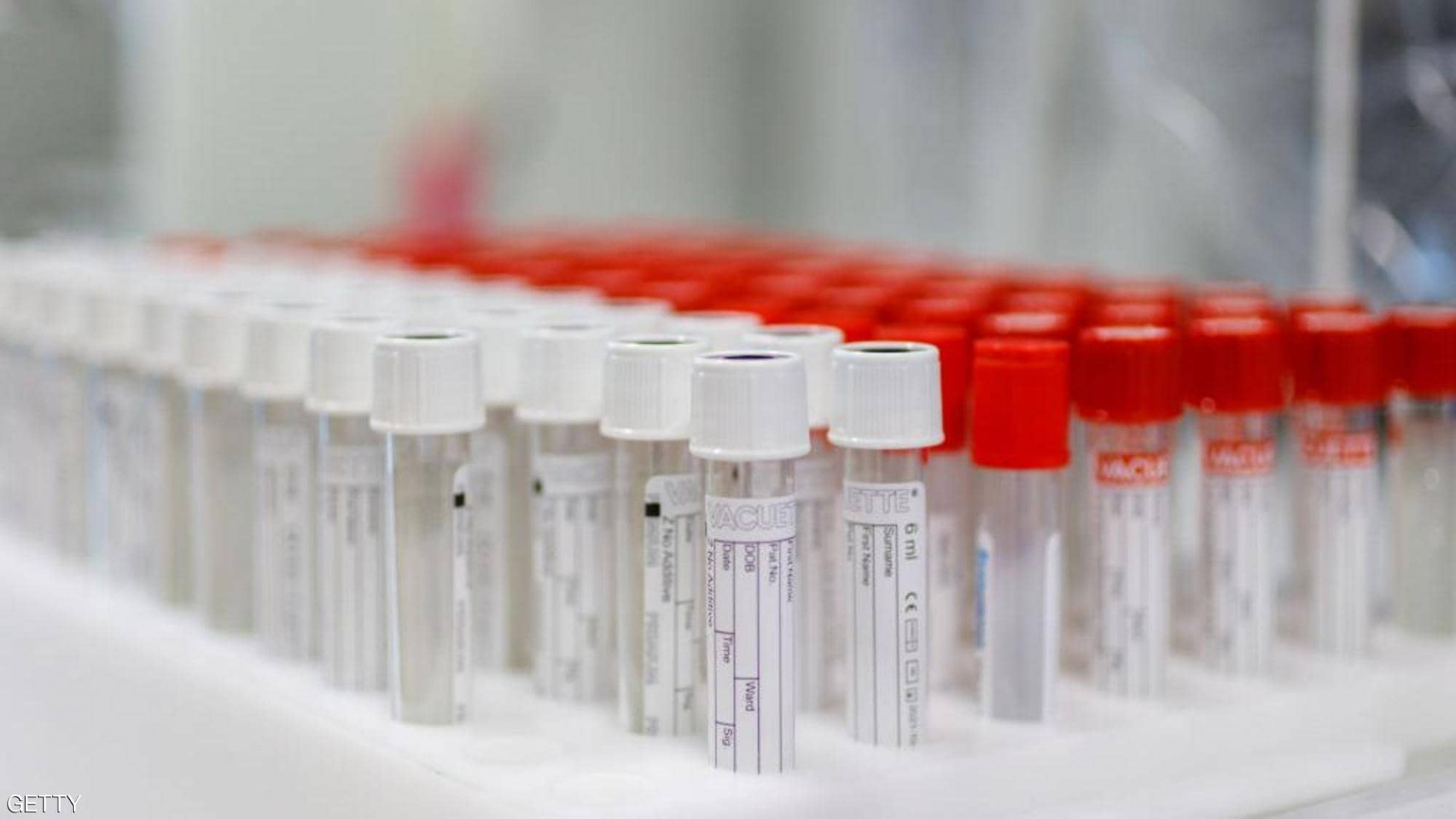 Russian to start Coronavirus vaccination in October 