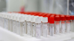 Russian to start Coronavirus vaccination in October 