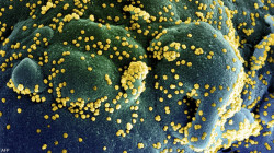 Researchers look into cells infected with new coronavirus