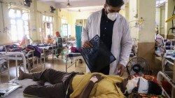 الهند تسجل أول إصابة لامرأة بجدري القردة