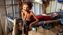 World Bank: 70% of Yemenis are at risk of starvation