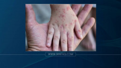Monkeypox: WHO calls for urgent action in Europe