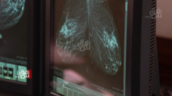 سرطان الثدي وأكتوبر.. حملة كبرى لتوعية النساء في العراق (صور)