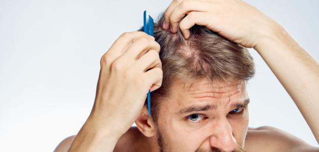 دراسة تحذر من مشروبات تؤدي إلى تساقط الشعر عند الرجال
