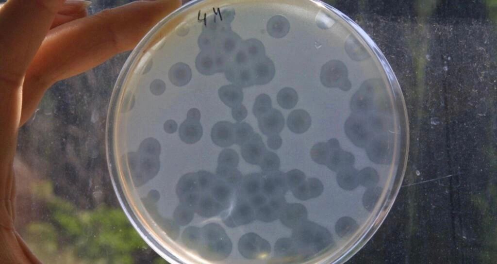 دراسة علمية ترصد بكتيريا مقاومة للمضادات الحيوية في "الغيوم"