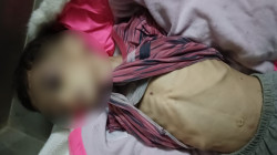 وفاة طفلة ببغداد إثر تعرضها لتعنيف أُسري
