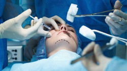 القصة الكاملة.. فوضى مراكز التجميل تطيح بأطباء الأسنان في العراق