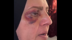 "ضربت نفسها".. شرطة الرصافة تنفي تعرض امرأة للتعذيب