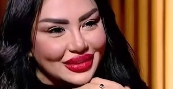 بوجه ممتلئ وشفاه منتفخة.. فنانة مصرية تصدم الجمهور بـ"لوك" جديد (صور)