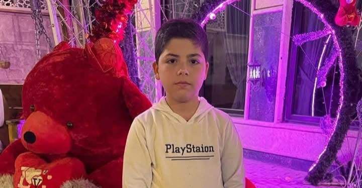 كان ميت سرسريا.. داء الكلب ينهي حياة طفل في ديالى