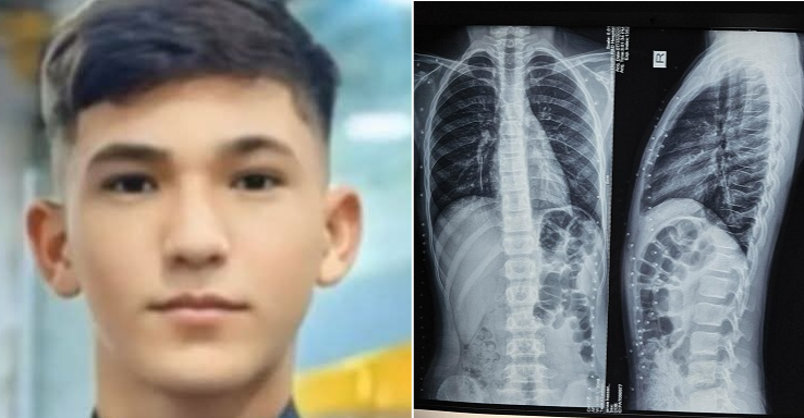 تدخلات طبية تعيد فتى "من الموت" وتنقذ حياة فتاة في محافظتين