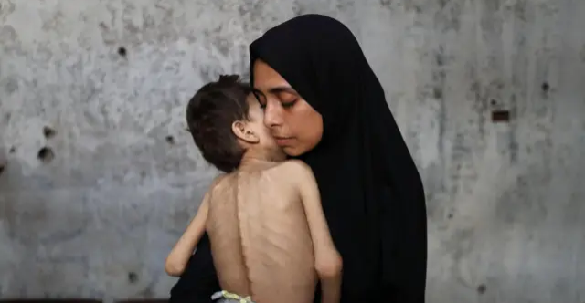 الأونروا: الناس في غزة "جثث تتحرك"