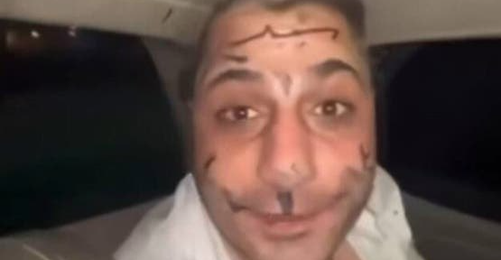 فيديو "مهين" لمطرب شعبي يثير غضب السوريين.. والداخلية تنفي مسؤوليتها