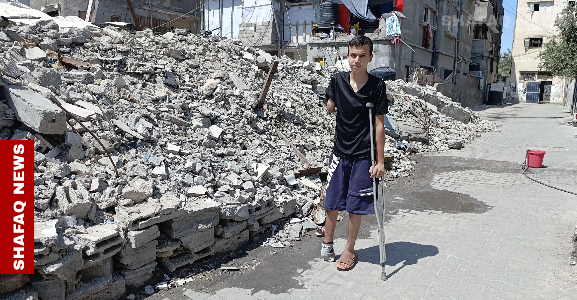 War scars: Gaza boy’s future hangs by a thread
