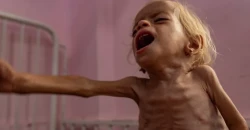 "الكلمات نفدت".. غوتيريتش: مجاعة غزة فشل للبشرية