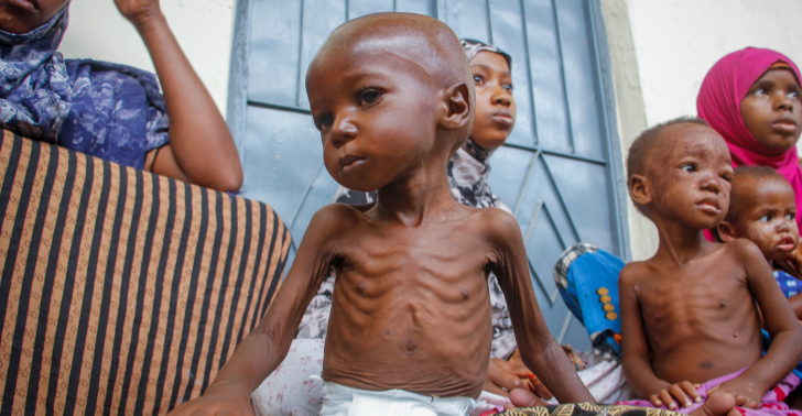 UNICEF: 315,000 children in Sudan face severe malnutrition