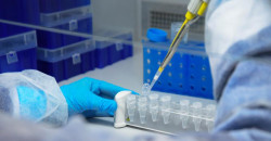 اكتشاف فيروس خطير ينتقل بواسطة الخفافيش في أستراليا