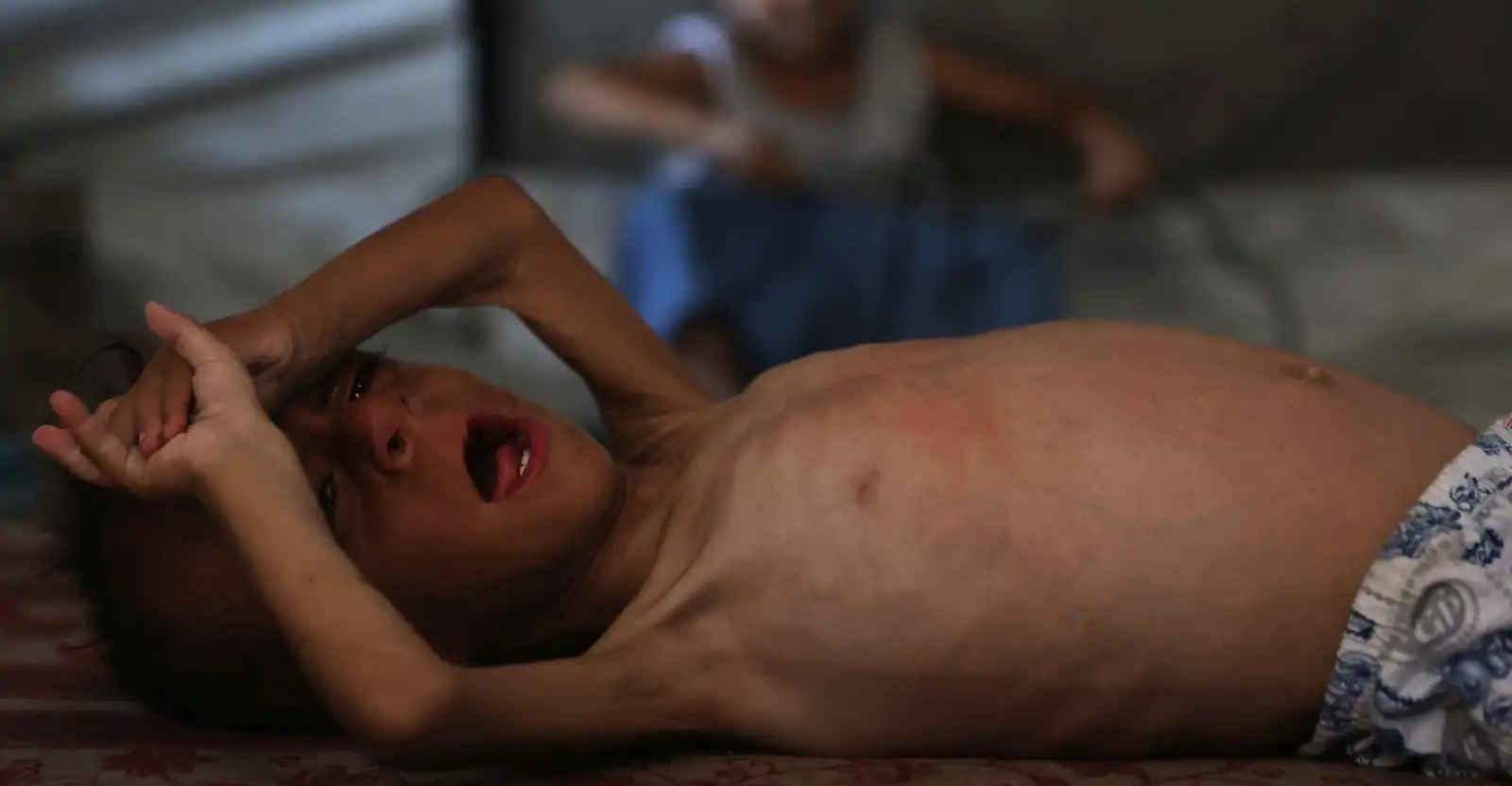 غزة.. المجاعة تفتك بالمزيد من الضحايا والحصيلة تصل إلى 422 وفاة