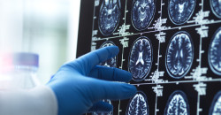 ابتكار إماراتي يوظف الذكاء الاصطناعي لإحياء ذكريات مرضى الزهايمر والخرف