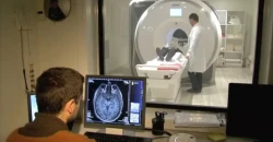 اليابان تفك لغز "ضبابية الدماغ" بعد كورونا