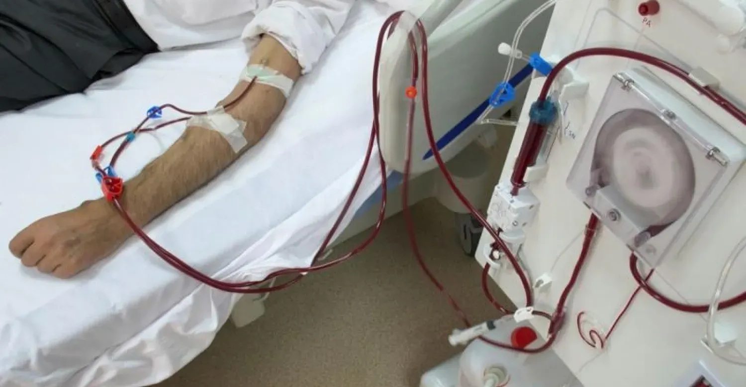 إنجاز طبي قد ينهي أزمة زراعة الكلى عالمياً