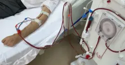 إنجاز طبي قد ينهي أزمة زراعة الكلى عالمياً