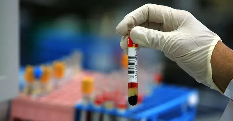 نقطة دم واحدة قد تنقذ حياتك.. طريقة "غير مسبوقة" لكشف السرطان مبكراً