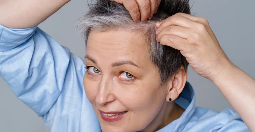 ما علاقة شيب الشعر بالسرطان؟