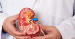 تضاعف أعداد المصابين بأمراض الكلى المزمنة خلال 35 عاماً