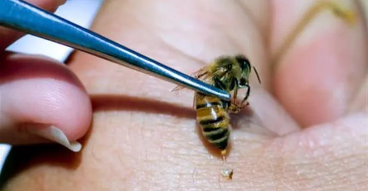 سم النحل يحدث ثورة في العناية بالبشرة ويثبت فعاليته في مكافحة التجاعيد