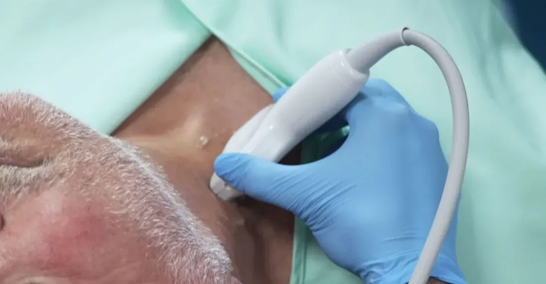 فحص طبي جديد يتنبأ بالنوبات القلبية قبل حدوثها