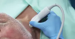 فحص طبي جديد يتنبأ بالنوبات القلبية قبل حدوثها