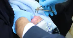 مولود جديد في العراق يفاجئ الأطباء بـ"سن لبني"