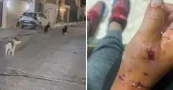 Child critically injured in stray dog attack in Al-Anbar