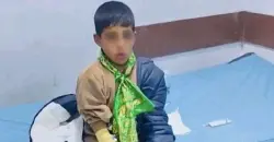 إصابة خطيرة بداء الكلب لطفل إثر "عضة" في بابل