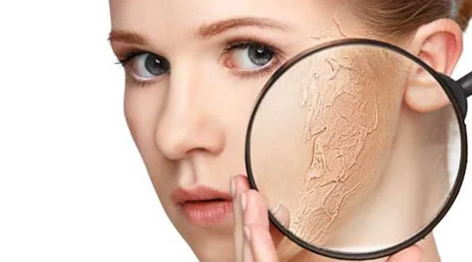 ‏پەنج زەیت ئەرا ئەو کەسەیلە خاوەن پووس هشکن