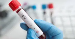 إصابة شاب بـ"الإيدز" يفتح ملف "العدوى الصامتة" في بغداد