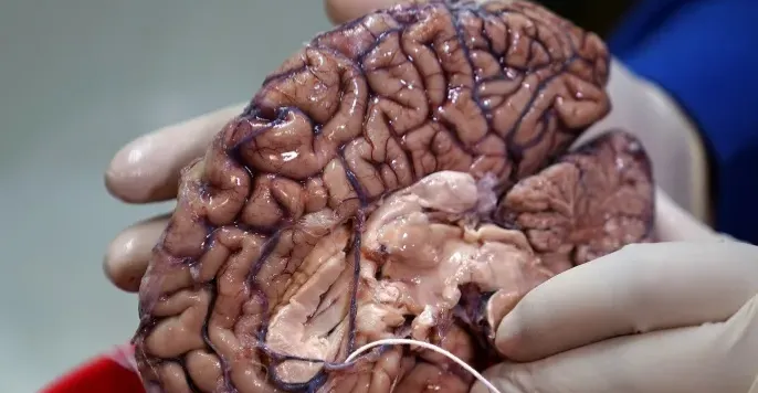 خبير روسي: دماغ الإنسان لا يشيخ