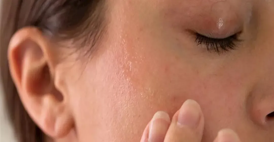 نقص الفيتامينات وسوء التغذية أبرز أسباب جفاف الجلد