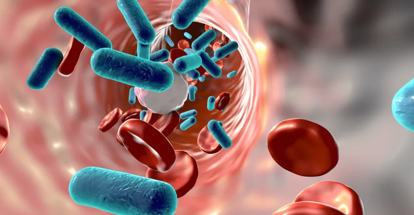 "تعفن الدم".. مرض صامت يسرق الأرواح