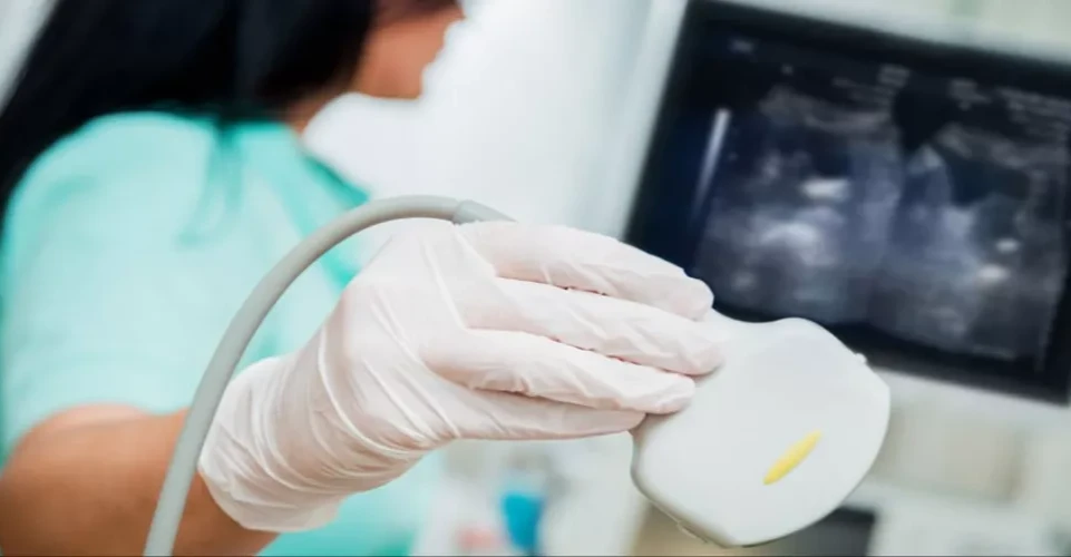 ‏أعراض خفية ومعاناة نفسية.. "تكيّس المبايض" يهدد صحة النساء العراقيات بصمت