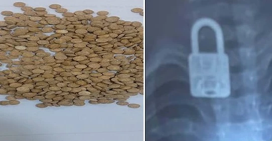 النجف والأنبار.. ضبط 600 حبة كبتاغون وإنقاذ طفل ابتلع "قفلاً" (صور)