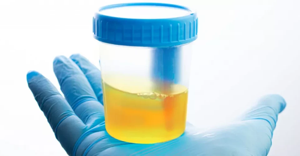 باحثون يبتكرون نظاماً ذكياً لتشخيص اضطرابات التبول من فيديو مصور