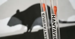 تسجيل حالة إصابة بفيروس "هانتا" في إسبانيا