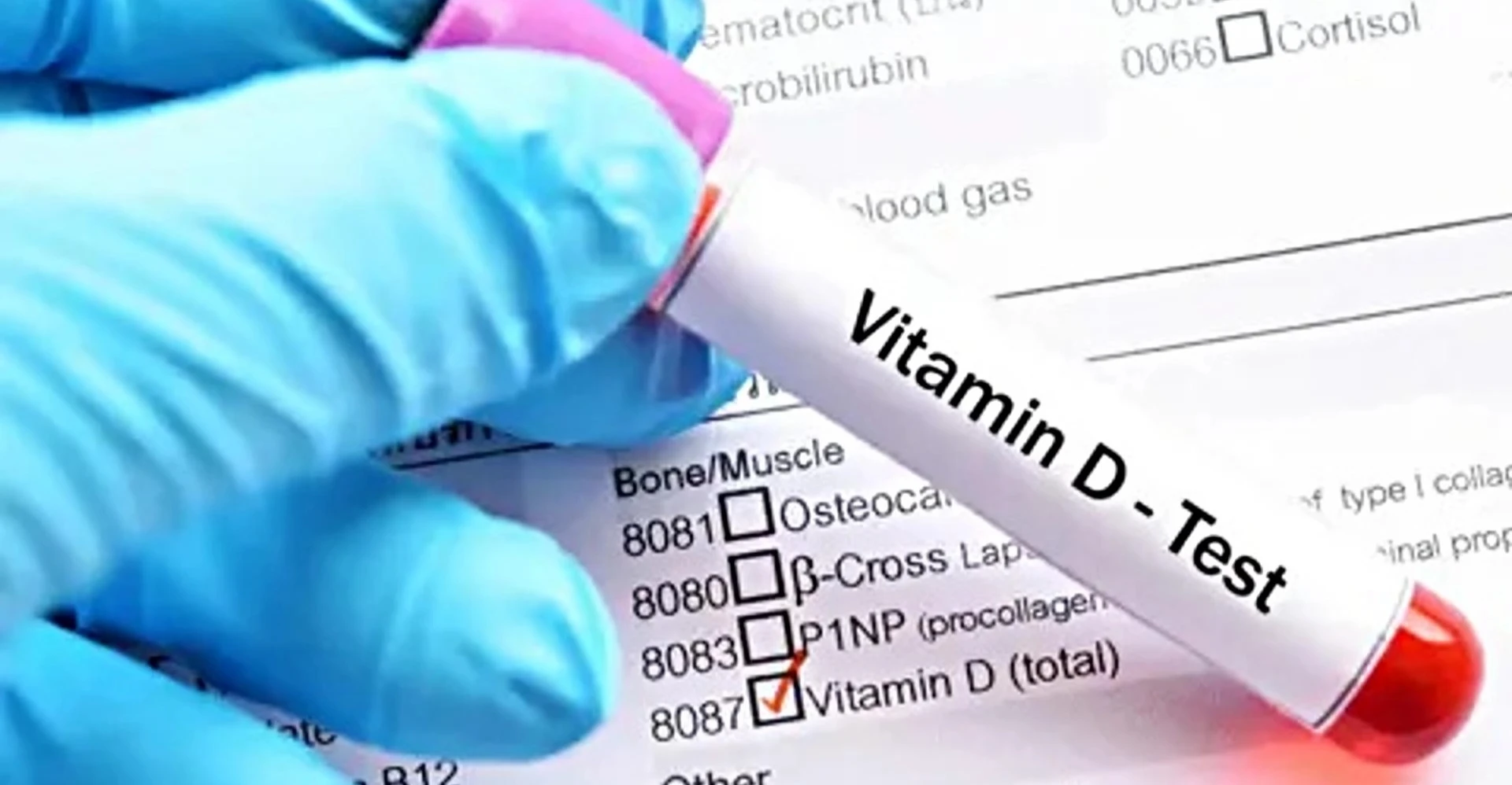 Uzmanından D Vitamini Uyarısı: Bilinçsiz Kullanım Böbrek Taşına Yol Açıyor