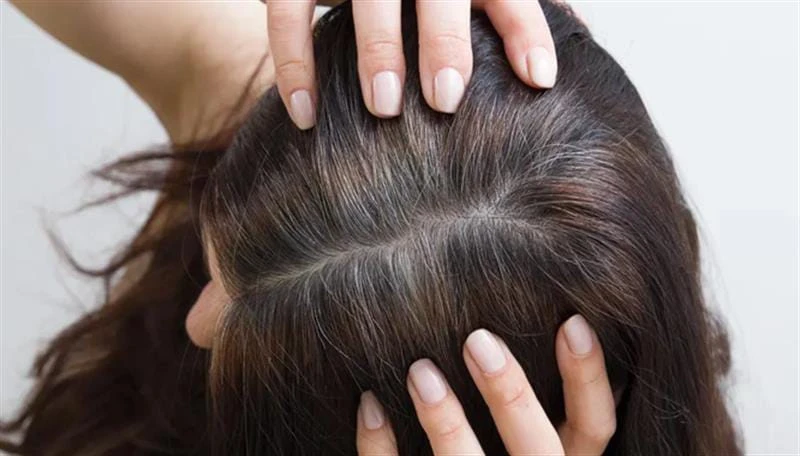 ‏نهێنی پشت چەرمگەوبوین گیس چەیگە؟