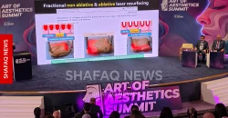 Al-Sulaymaniyah hosts international cosmetic surgery conference