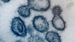 إسبانيا.. ثبوت إصابة قطة نافقة بفيروس كورونا