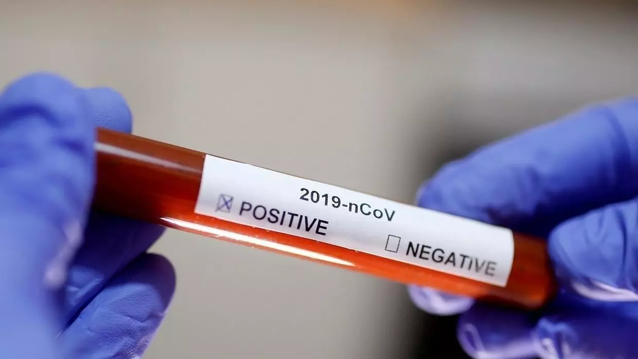 Iraqi family get infected with Corona virus in Italy